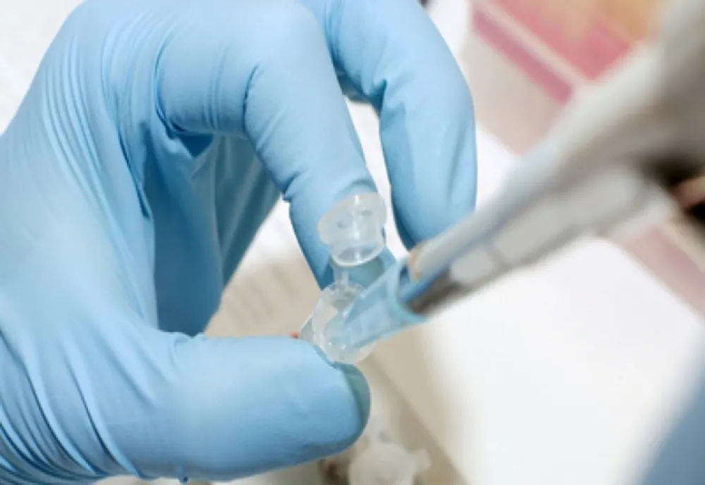 Franța a emis un decret de izolare pentru persoanele suspectate de infectare cu hantavirus